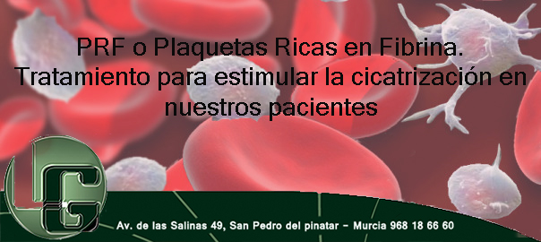 PRF o Plaquetas Ricas en Fibrina: