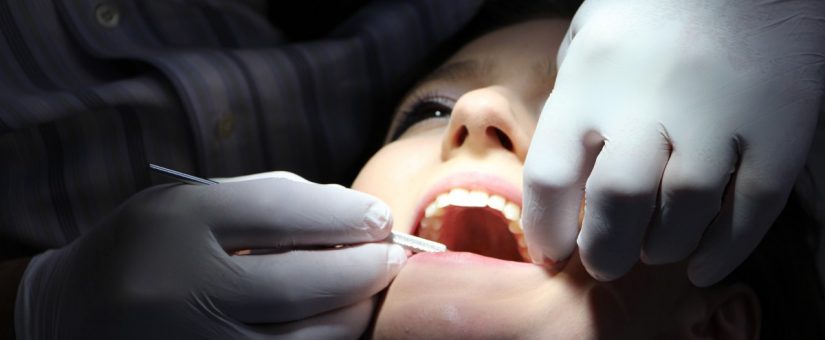 Las preguntas mas frecuentes que se realizan los pacientes antes de un tratamiento con implantes dentales (parte VI)