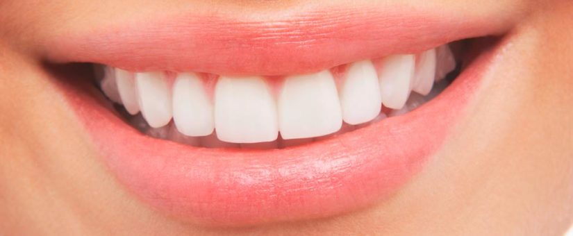 Hábitos para Conseguir una Higiene Dental