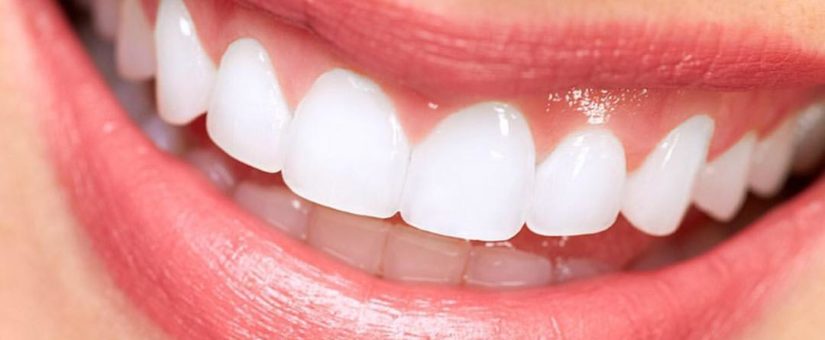 ¿Cómo se forma una caries?