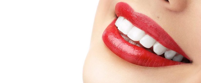 Adelántate a la primavera: el mejor momento para un blanqueamiento dental