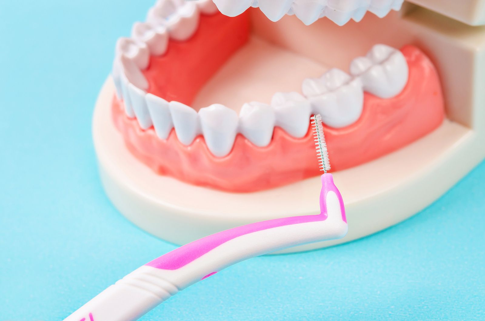 ¿Qué es la higiene interproximal y por qué nos conviene tanto? LG DENTAL