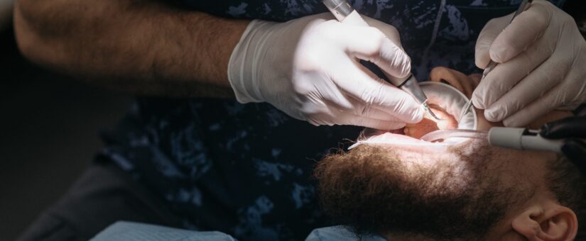 ¿Cómo sé si necesito una endodoncia?