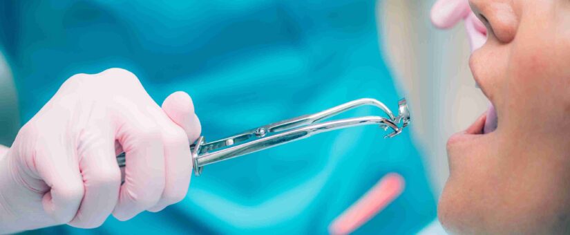 ¿Cuáles son los principales síntomas con los que hay que realizar una endodoncia?