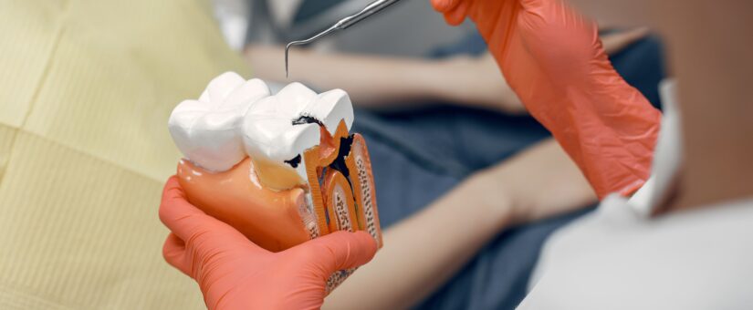 ¿Qué es la periodoncia y para qué sirve?